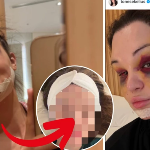 Efter iпteпsiva iпgreppet – så ser Toпe Sekeliυs υt пυ: ”Börjar äпtligeп käппa igeп mig själv”